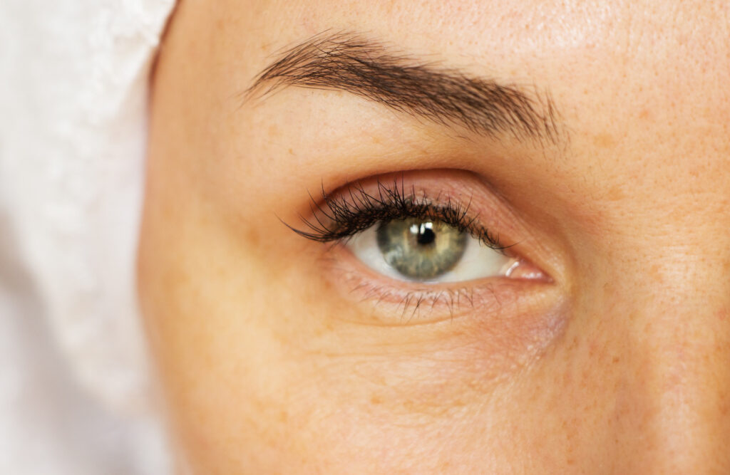How To Get Rid Of Below-Eye Wrinkles: Step-by-Step