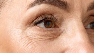 How To Get Rid Of Below Eye Wrinkles: Step-by-Step