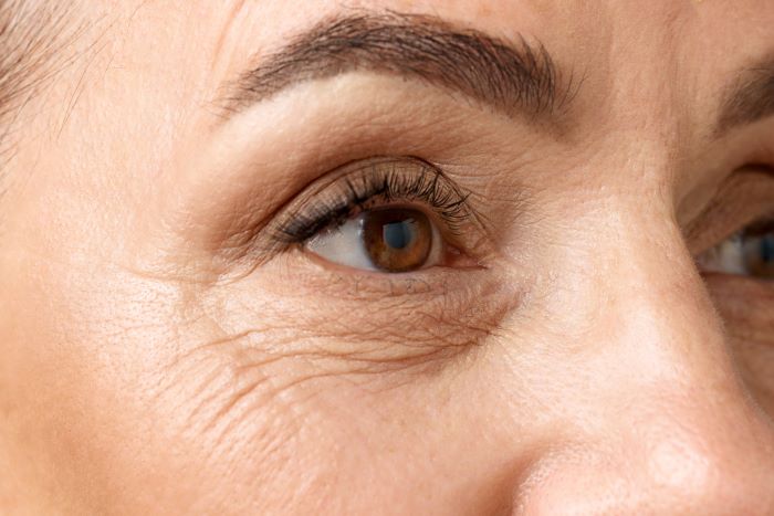 How To Get Rid Of Below Eye Wrinkles: Step-by-Step