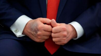 Trump bruised hand