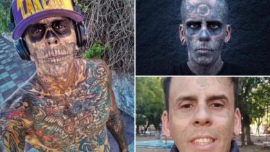 Brazil's Most Tattooed Man Undergoes Painful Laser Removal After Religious Conversion