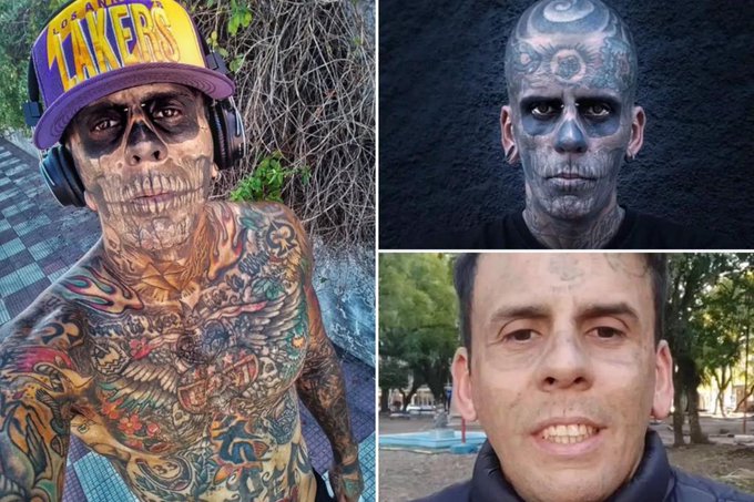 Brazil's Most Tattooed Man Undergoes Painful Laser Removal After Religious Conversion